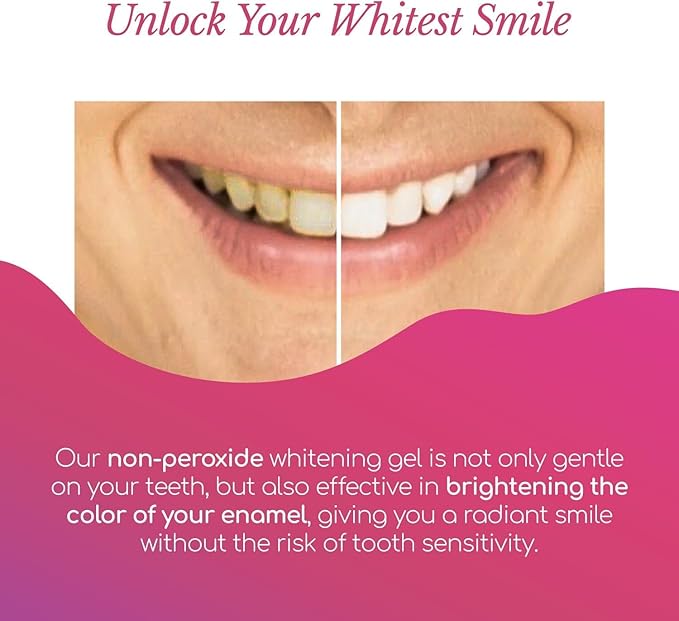 Smilesaver Peroxide-Free Teeth Whitening Pen – Gentle Formula for Sensitive Teeth – Portable Stain Remover Pen for a Radiant Smile – Easy-to-Use Oral Care Product for Brighter Enamel (3 Pack)