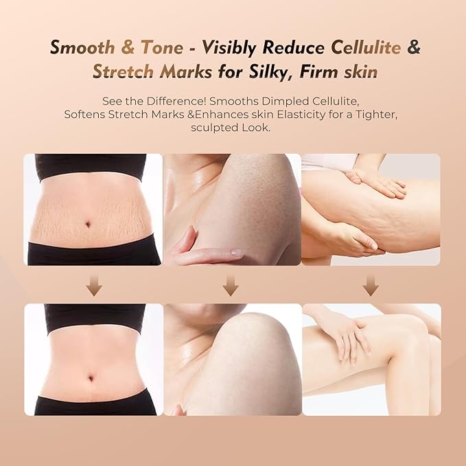 Microcurrent Lymphatic Drainage Massager for Legs Arms Belly, Body Sculpting Machine with Microcurrent, Cellulite Massage Tool,Light, Heat & Vibration, Promotes Circulation Skin Renewal
