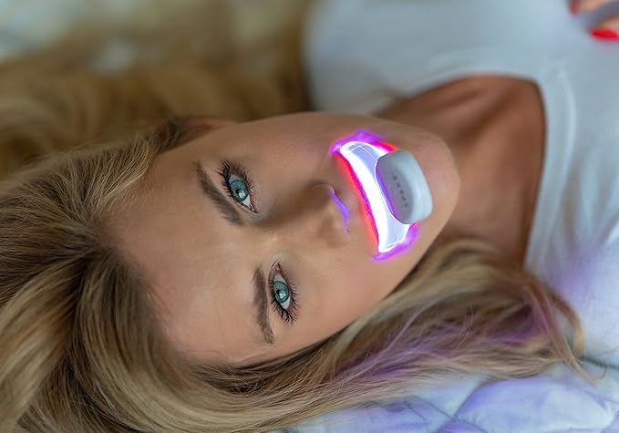 SPARX Wireless Teeth Whitening Kit with LED Light for Sensitive Teeth Remove Stains Like Coffee, Smoking, Wine. Whiten Smile for Long Lasting Results, Includes 3 Gel Syringes, 1 Dual LED Mouthpiece