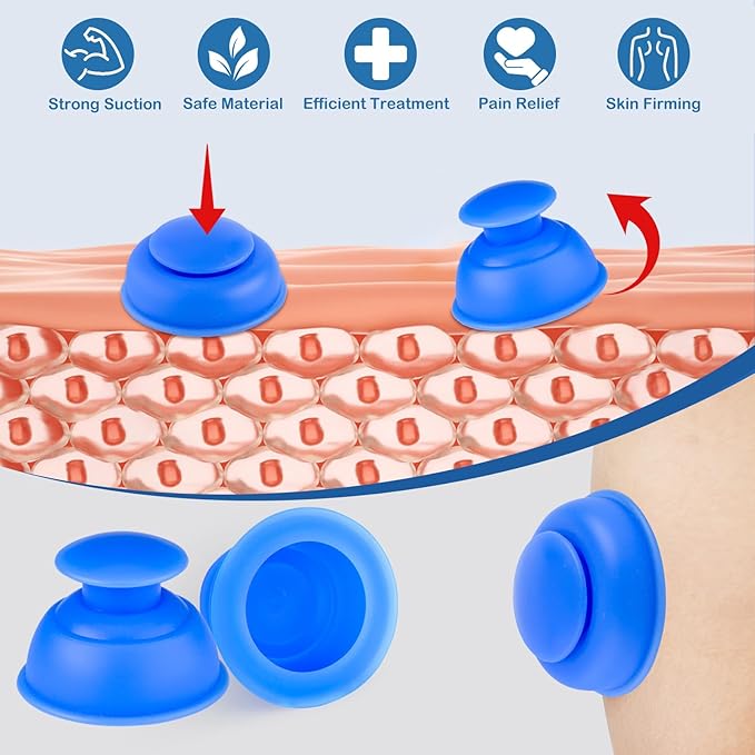 Silicone Cupping Therapy Sets-10pcs Professional Vacuum Cupping for Myofascial Massage/Joint Pain/Anti Cellulite/Deep Muscle Relief & More(Blue)