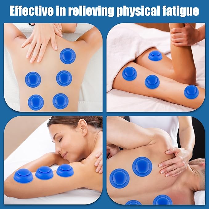 Silicone Cupping Therapy Sets-10pcs Professional Vacuum Cupping for Myofascial Massage/Joint Pain/Anti Cellulite/Deep Muscle Relief & More(Blue)