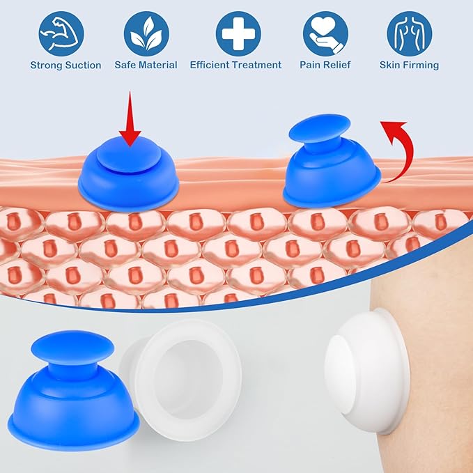 Silicone Cupping Therapy Sets 10pcs,Professional Vacuum Cupping for Myofascial Massage/Joint Pain/Anti Cellulite/Deep Muscle Relief & More(10pcs,White+Blue)