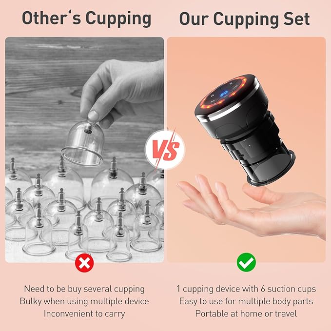 UBALANCE Cupping Kit for Massage Therapy, Cupping Therapy Set 6 Cups, Electric Smart Cupping Machine, 4 in 1 Negative Pressure Massager with 12 Modes for Fatigue Relief, Black