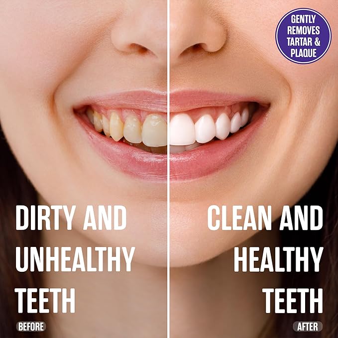 SprinJene Fluoride Free Toothpaste for Sensitive Teeth & Gum Fresh Breath Helps Dry Mouth Natural Non Fluoride Toothpaste for Adult SLS Free, Toxic Preservative Free with Black Seed Oil & Zinc 2 Pack