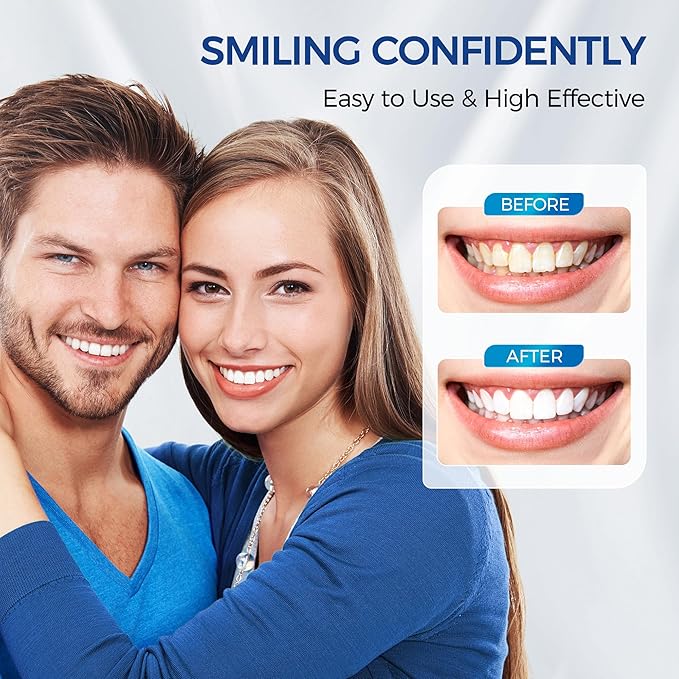 Teeth Whitening Kit for Sensitive Teeth,with 4 Carbamide Peroxide Pen & 1 Remineralization Pen,LED Accelerator Light Non,Tooth Whitener Professional Oral Care Gently Yet Effectively Removes Stains