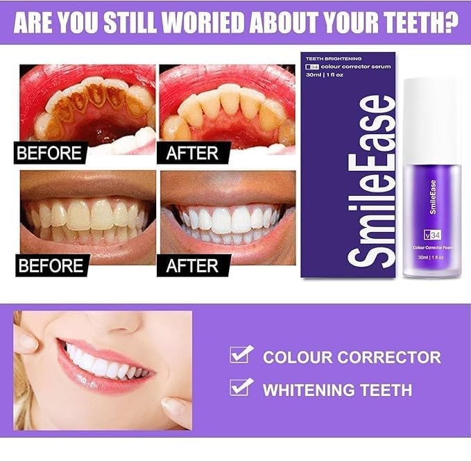 Purple Toothpaste for Teeth Whitening, Purple Whitening Toothpaste for Adults,Tooth Stain Remover Gel - Tooth Whitener Suitable for Smoking, Coffee, and Removing Dental Stone ﻿(2fl oz/60ml)