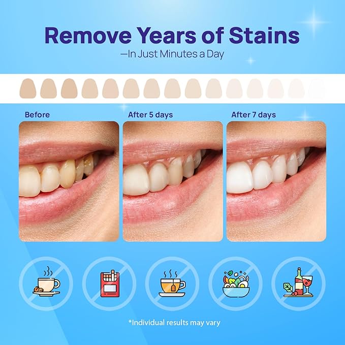 Whitebite Pro Upgraded Teeth Whitening Strips 28 Strips (14 Treatments) | Enamel-Safe | Deep Stains Removal | Non-Slip Design | Whitening Without Any Harm | Mint