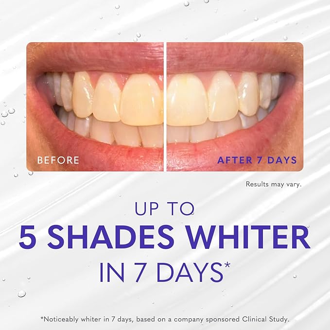 Smileactives Teeth Whitening Gel for Toothpaste with Clinical-Grade Hydrogen Peroxide, Tooth Stain Remover for White Teeth, Dentist Quality Pro Whitening Gel to Remove Coffee Stains, 3 Pack, 1 oz