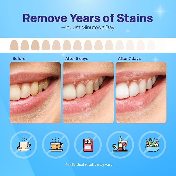 Whitebite Pro Upgraded Teeth Whitening Strips 14 Strips (7 Treatments) | Enamel-Safe | Deep Stains Removal | Non-Slip Design | Whitening Without Any Harm | Mint